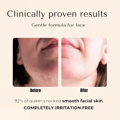 PLANTEVA™ –  Cyperus Rotundus Oil – Hair Reduction Oil